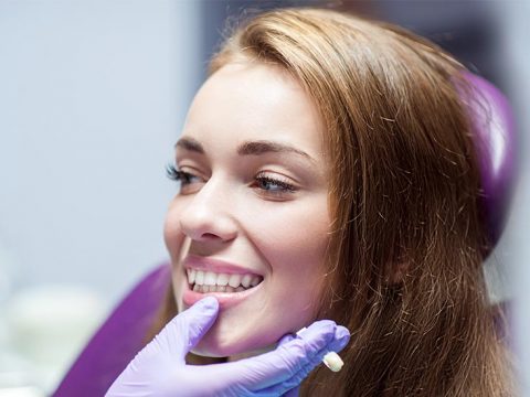 5 Common Misconceptions About Porcelain Veneers
