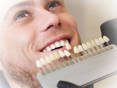 All You Need to Know About Dental Veneers