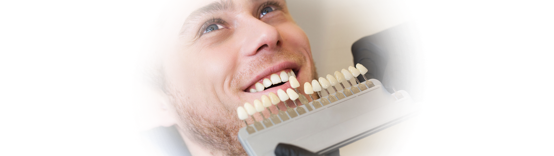 All You Need to Know About Dental Veneers