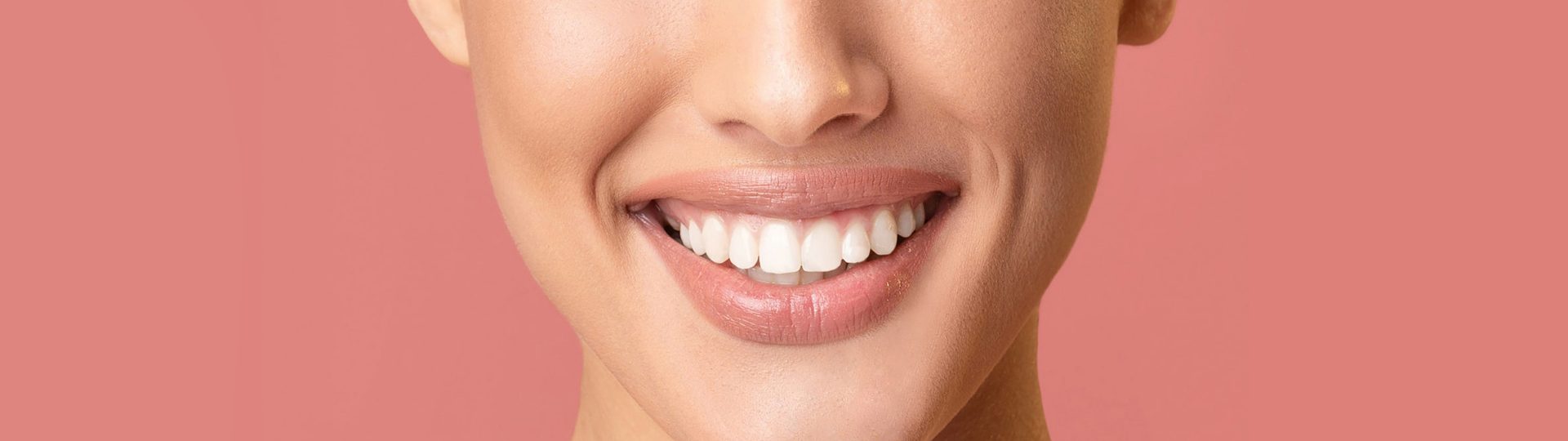 Everything You Should Know about Take-home Teeth Whitening Kits 
