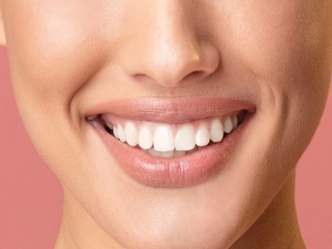 Everything You Should Know about Take-home Teeth Whitening Kits 