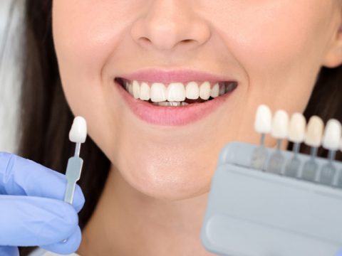 What Are the Effects of Polishing and Tooth Bleaching