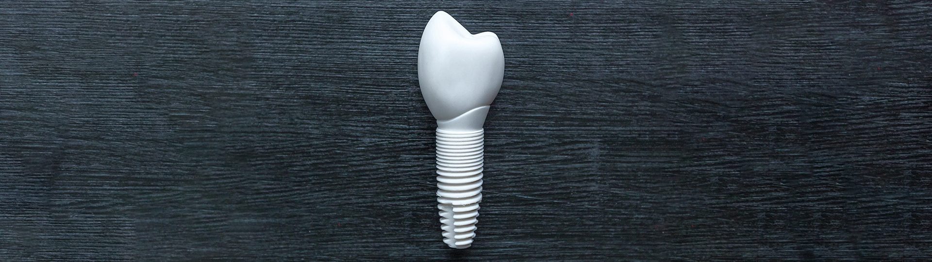 Alternatives for Traditional Dental Implants