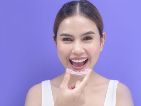 The Invisalign Process: 3 Steps To Straighten Your Teeth