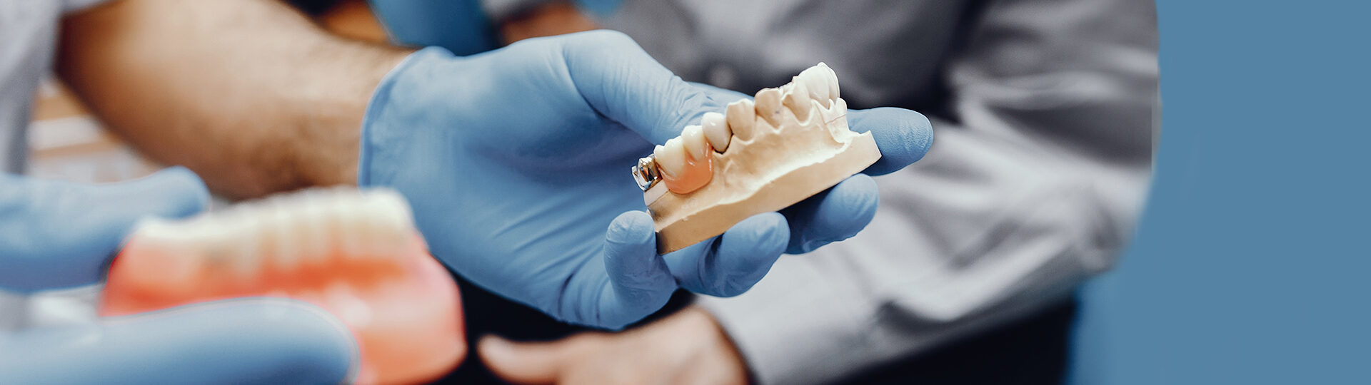How Dental Bridges Help Restore Confidence in Your Smile