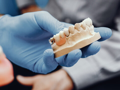 How Dental Bridges Help Restore Confidence in Your Smile